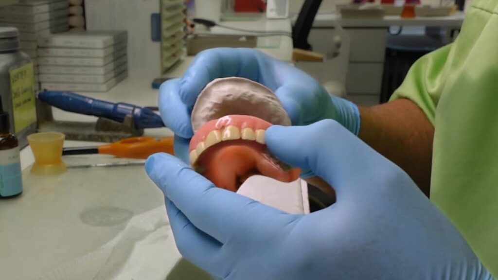 Tanntekniker prøver protese paå gipsmodell