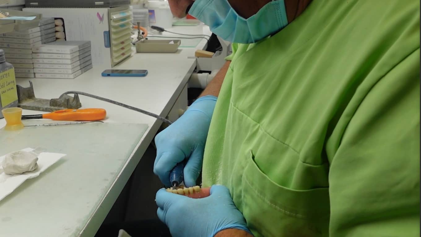 Tanntekniker sliper ut av en sprukket-protese